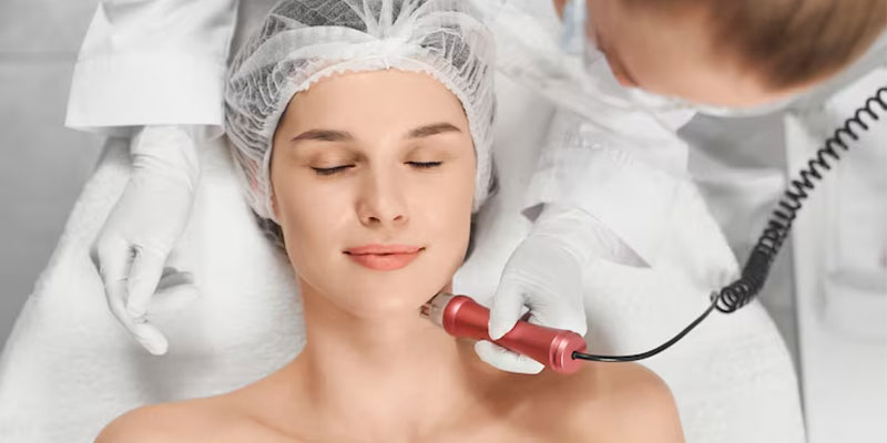 آر اف فرکشنال