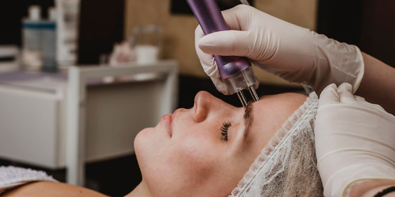 میکرودرم ابریژن