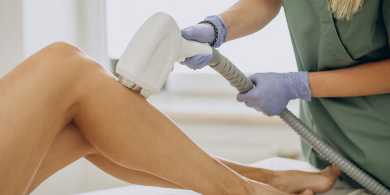 لیزر موهای زائد