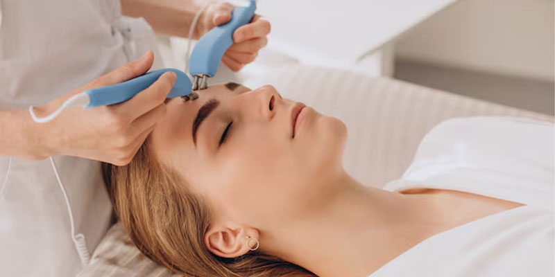 بلفاروپلاستی غیر جراحی (پلکسر)